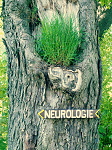 Neurol�gia